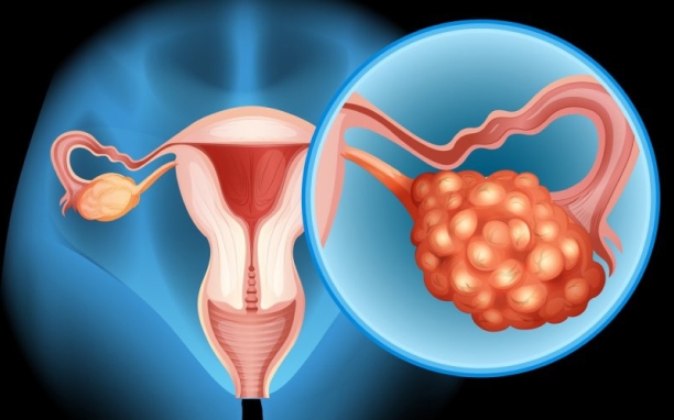 Gynecological Oncology Surgeries
